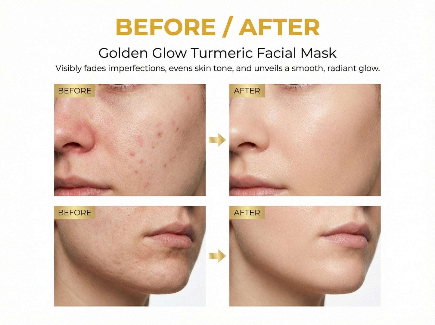 Golden Glow Turmeric Facial Mask – Hydrate, Brighten & Renew.